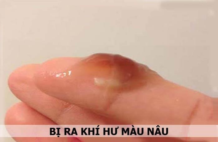 Ra dịch nhầy màu nâu có phải mang thai 