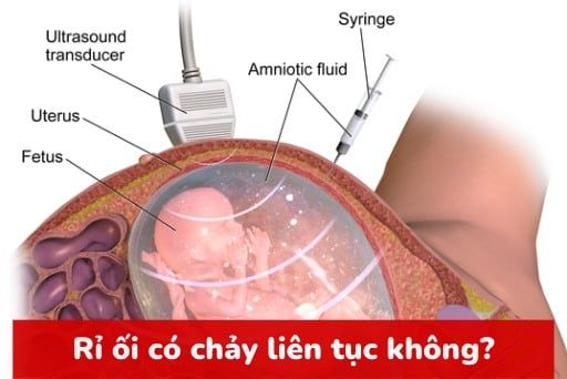 Rỉ ối có chảy liên tục không