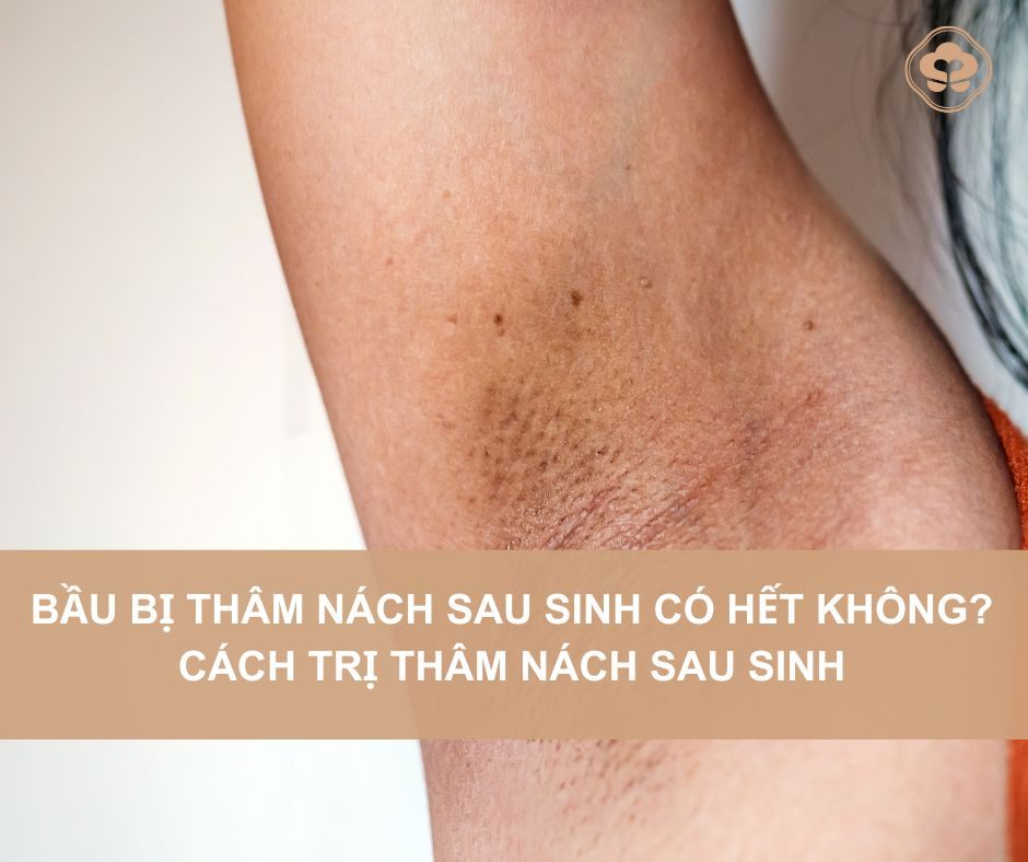 Thâm nách khi mang thai có hết không?