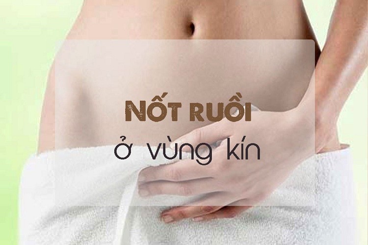 Phụ nữ có nốt ruồi ở vùng kín là tốt hay xấu?