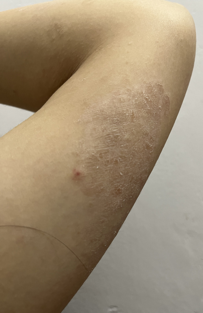 Cho em hỏi da body em bị tình trạng như