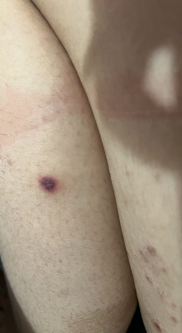 Cho em hỏi da body em bị tình trạng như