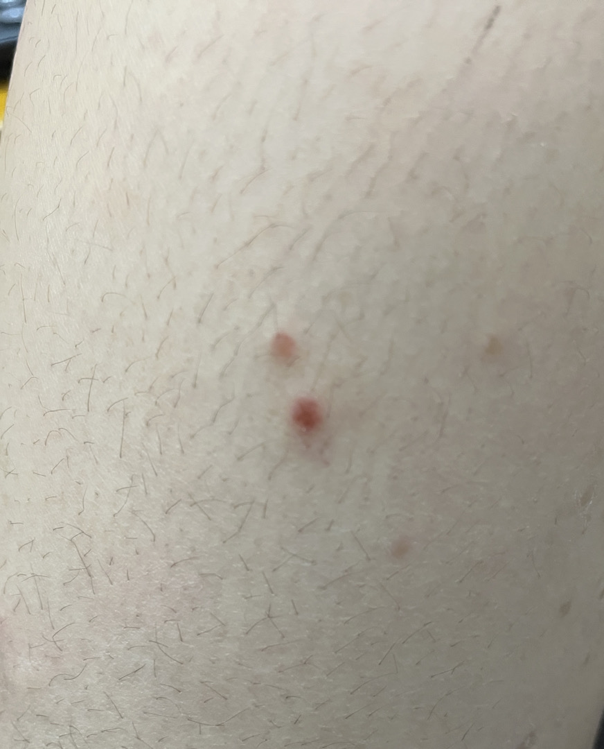 Cho em hỏi da body em bị tình trạng như