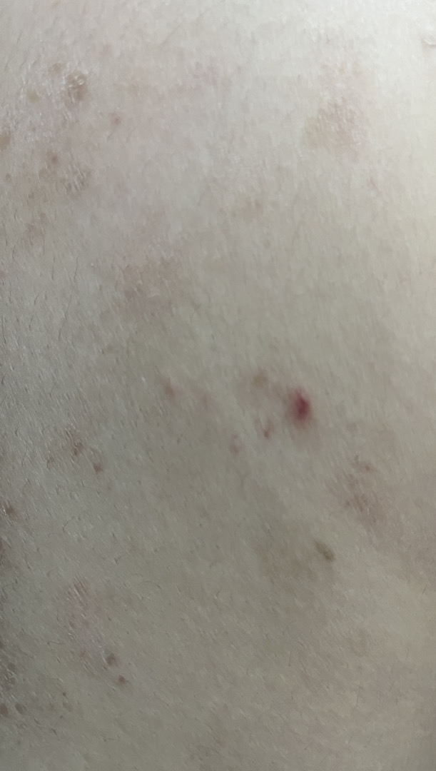 Cho em hỏi da body em bị tình trạng như