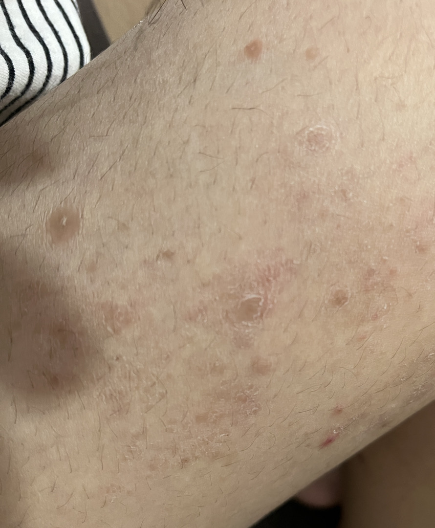 Cho em hỏi da body em bị tình trạng như