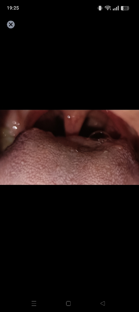 bệnh truyền nhiễm