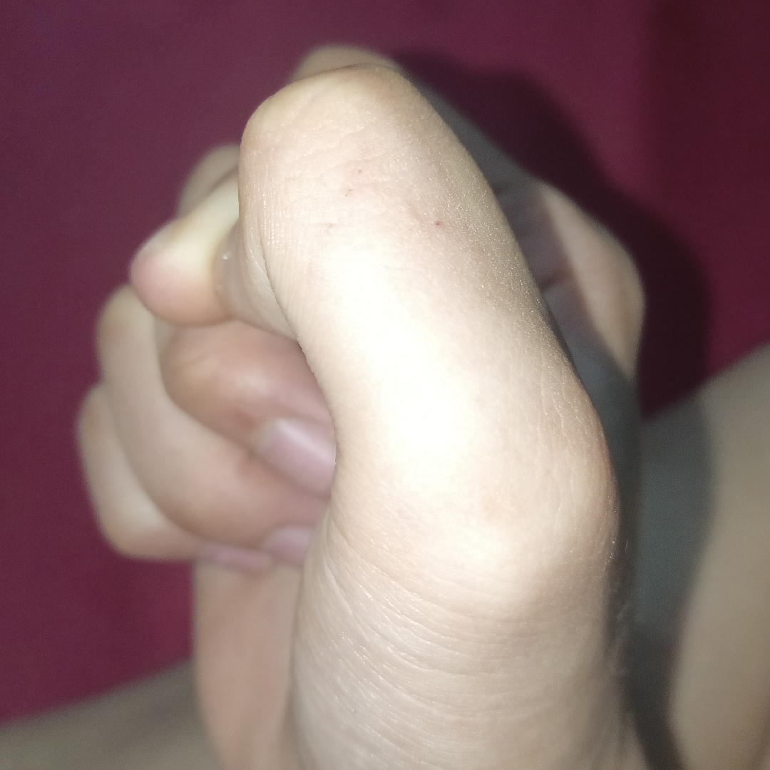 Vết mèo cào nông không chảy máu, rửa sát trùng có cần tiêm phòng?